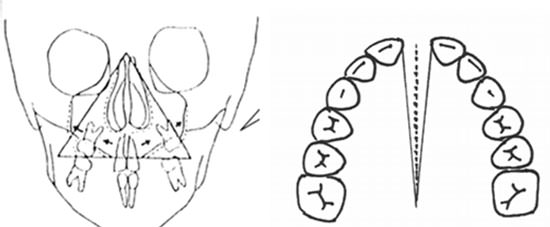 Figura 4