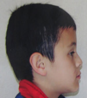 Figura 2