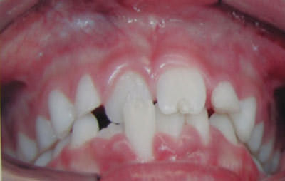 Figura 7