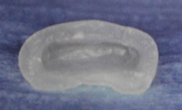 Fig. 12 Vaciado de dentina del fragmento. Fuente: García C, Mendoza, A. (2003) (2)
