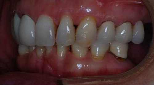 Figura 9