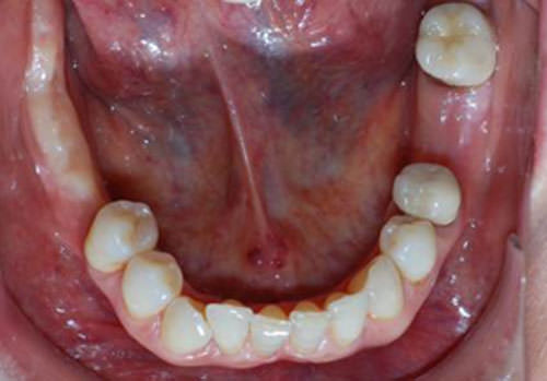 Figura 11