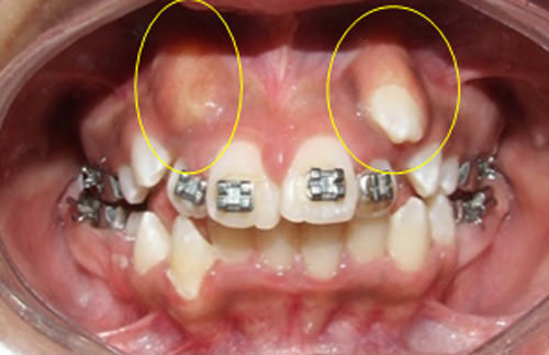 Figura 1 Fotografía extraoral de frente pre-tratamiento