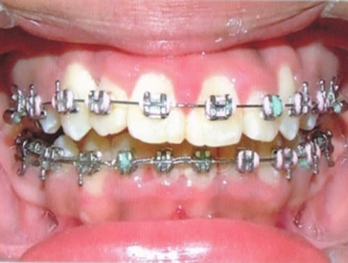 Fig. 10 Intraoral de frente