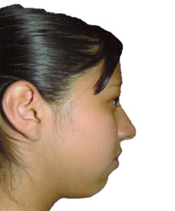 Fig. 12 Fotografía Lateral