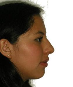 Fig. 16 Fotografía de perfil