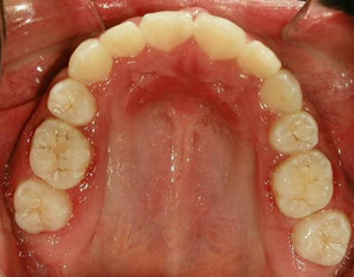 Fig. 21 Oclusal superior