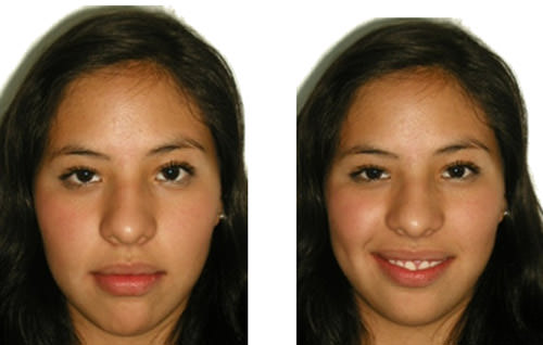 Fig 25 Fotografias finales del tratamiento