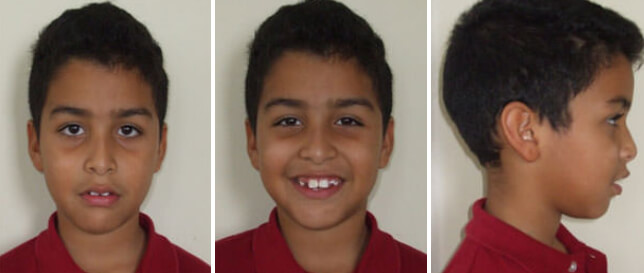 Fig. 1 Fotografía de Frente Fig. 2 Fotografía frente sonrisa Fig. 3 Fotografía perfil