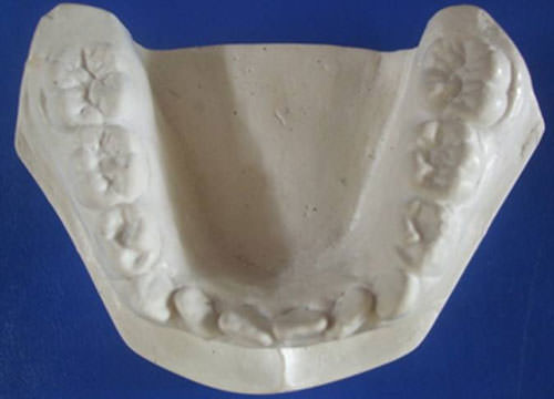 Fig. 8 Modelo arcada inferior