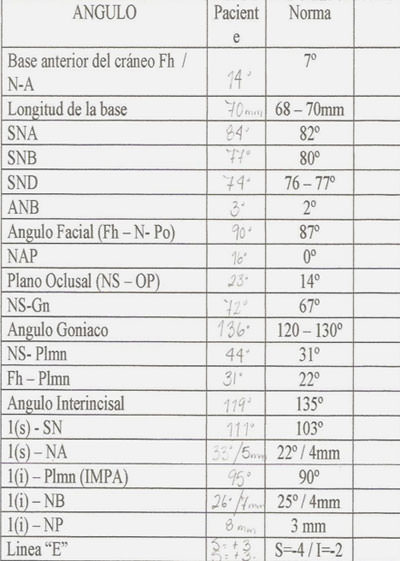 Análisis Universal