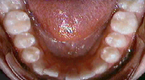 Fig. 4 Vista oclusal