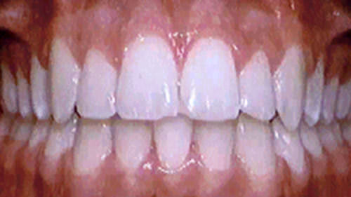 Fig. 5 Caso terminado
