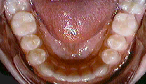 Fig. 6 Vista oclusal