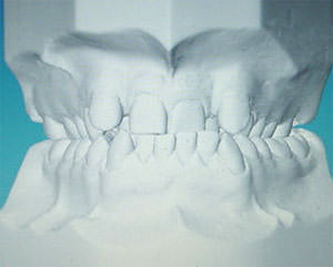 Fig. 7 Modelos de estudio