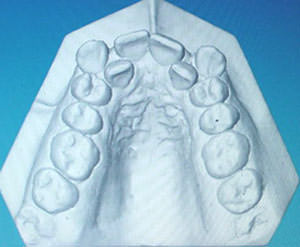 Fig. 8 Arco superior