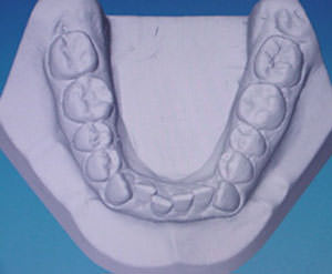 Fig. 9 Arco inferior