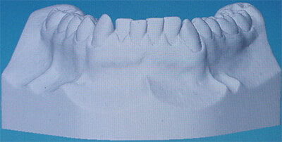 Fig. 11 Vista frontal inferior