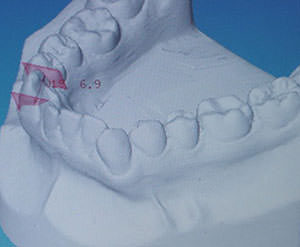 Fig. 15