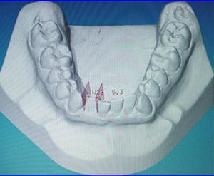 Fig. 16