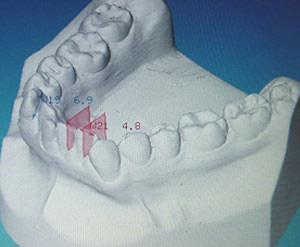 Fig. 17