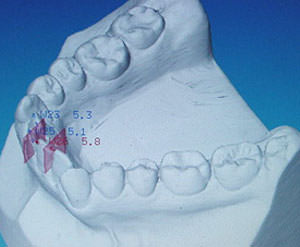 Fig. 18