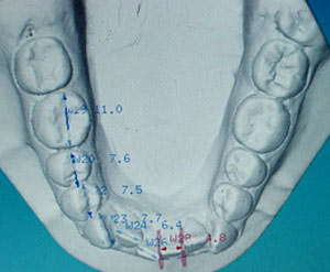 Fig. 19