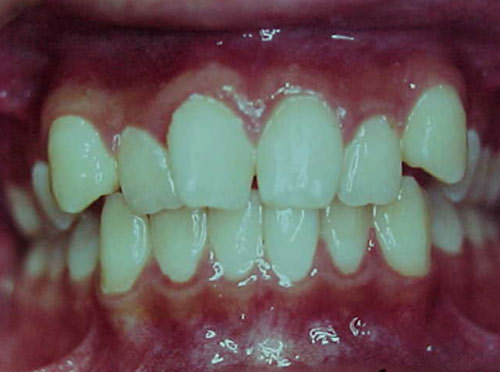 Fig. 24 Vista frontal