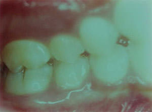 Fig. 25 Lateral derecha
