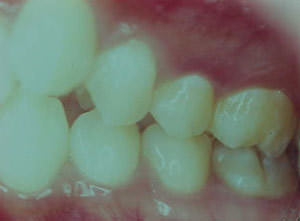 Fig. 26 Lateral izquierda