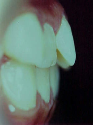 Fig. 27 Lateral