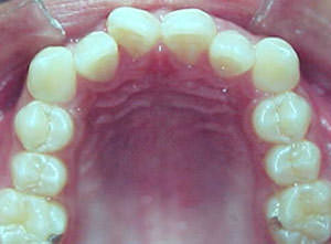 Fig. 28 Oclusal superior