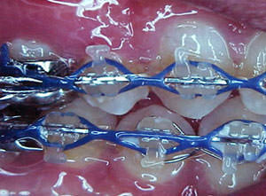 Fig 40 Lateral derecha