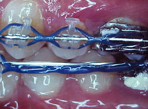 Fig. 41 Lateral izquierda