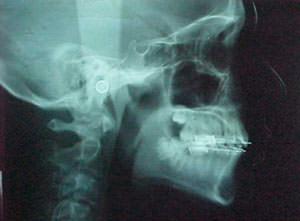 Fig. 43