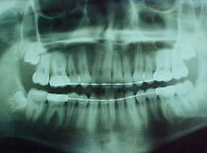 Fig. 44