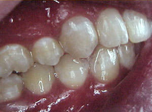 Fig. 47 Lateral derecha