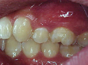 Fig. 48 Lateral izquierda