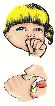 Habit - Suction Digital - Atypical deglutition - mouth breathing.