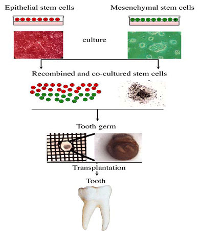 Use of stem cells for tooth formation in vitro and ex vivo. A tooth germ can be created in vitro after co-culture of isolated epithelial and mesenchymal stem cells. This germ could be implanted into the alveolar
