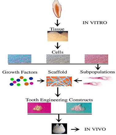bone and finally develop into a fully functional tooth. Construction of a bioengineered tooth. The association of tooth-derived stem cells with defined scaffolds in the presence of growth factors allows the creation of tooth specific constructs such as crown and root of missing parts of an injured tooth. These biological constructs could be used in dental clinics as substitutes for metal implants, crowns and restorative dental materials