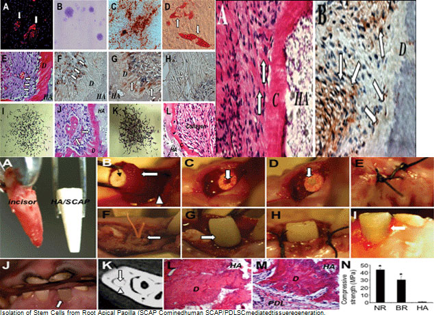 Isolation of Stem Cells from Root Apical Papilla (SCAP Cominedhuman SCAP/PDLSCmediatedtissueregeneration. Swine SCAP/PDLSC-mediated root/periodontal structure as an artificial crown support for the restoration of tooth function in swine. Mesenchymal Stem Cell-Mediated Functional Tooth Regeneration in Swine Songtao Shi