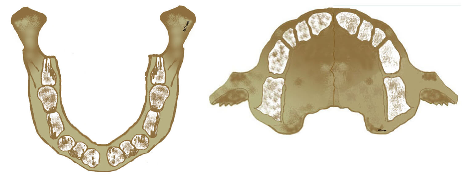 Fig. 4 Representacion esquematica de la Mandíbula y maxilar del recién nacido ®