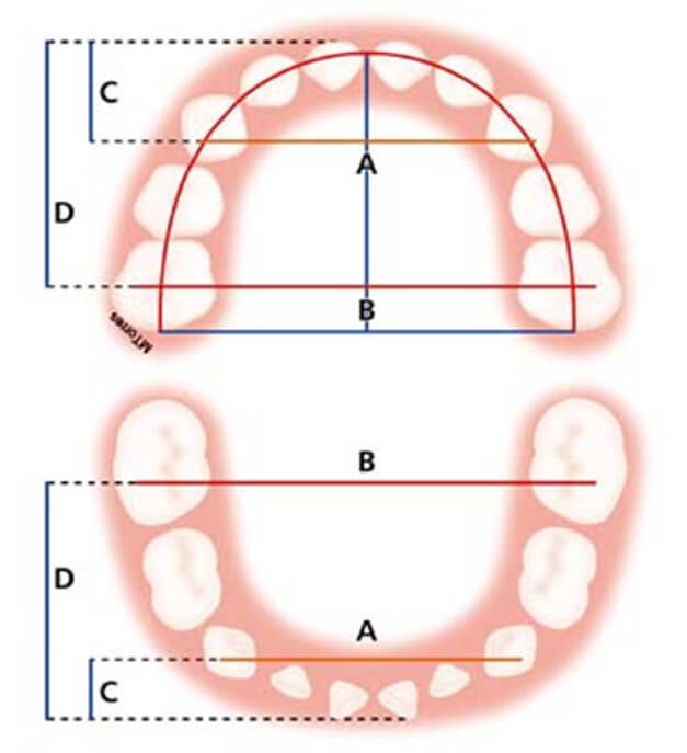 Fig. 11 Puntos de medida para determinar el ancho del arco dental primario ®