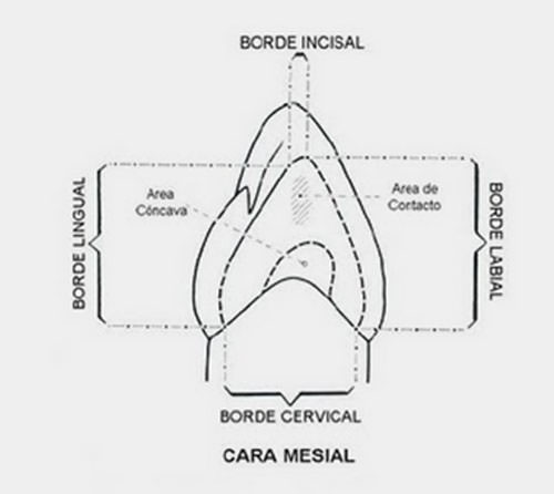 Figura Nº 3 Cara mesial del canino superior