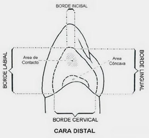 Figura Nº 4 Cara distal del canino superior