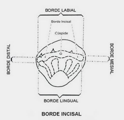 Figura Nº 5 Cara incisal del canino superior