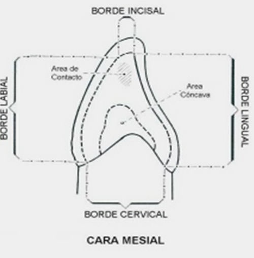 Figura Nº 8 Cara mesial del canino inferior