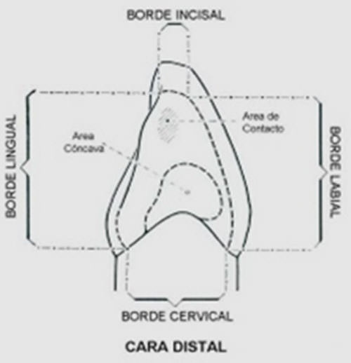 Figura Nº 9 Cara distal del canino inferior
