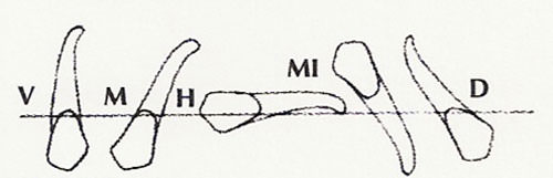 Figura Nº 15 Retenciones dentarias. Dirección.